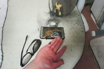 Galaxy Note 7就是危险品! 韩国男子手被烧伤